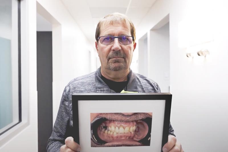 Male Dental Implants Patient Holding Before Image
