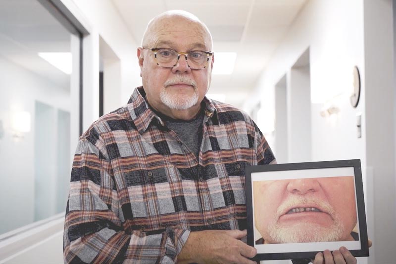 Man Dental Implants Patient Holding Before Image